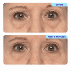 Instant Lift Eye Gel